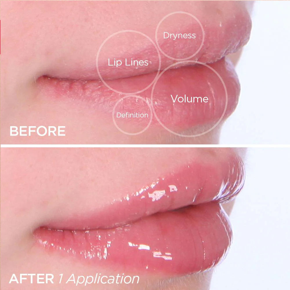 Natürliches Lippenaufpolsterungsserum – 5 ml